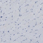 Anti-RRBP1 Antibody