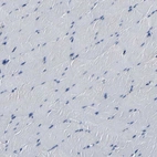 Immunohistochemical staining of human skeletal muscle shows low expression as expected.