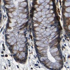 Anti-RRBP1 Antibody