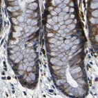 Immunohistochemical staining of human colon using Anti-RRBP1 antibody HPA011924.