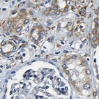 Anti-RRBP1 Antibody