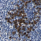 Anti-RRBP1 Antibody