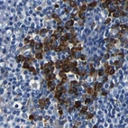 Immunohistochemical staining of human lymph node using Anti-RRBP1 antibody HPA011924.