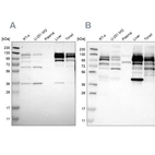Western blot analysis using Anti-RRBP1 antibody HPA011924 (A) shows similar pattern to independent antibody HPA009026 (B).