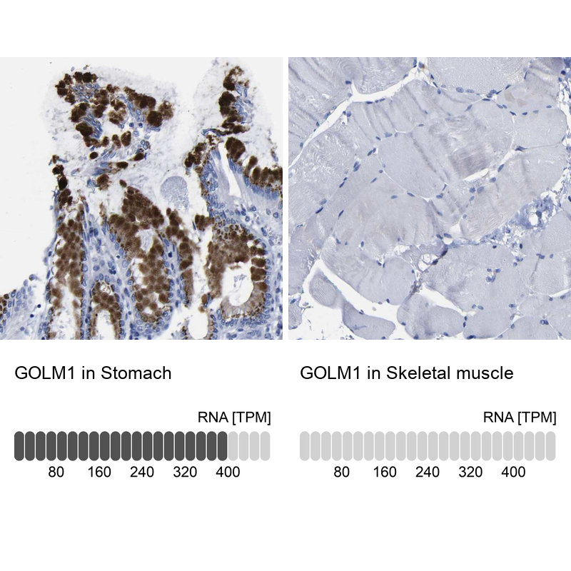 Anti-GOLM1 Antibody