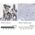 Anti-GOLM1 Antibody