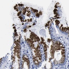 Immunohistochemical staining of human stomach shows high expression.