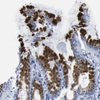 Immunohistochemical staining of human stomach shows high expression.