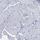 Immunohistochemical staining of human skeletal muscle shows low expression as expected.