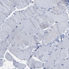 Immunohistochemical staining of human skeletal muscle shows low expression as expected.