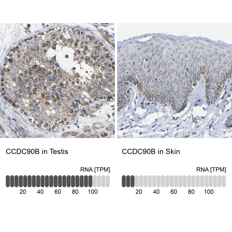 Anti-CCDC90B Antibody