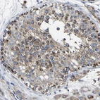 Immunohistochemical staining of human testis shows strong granular cytoplasmic positivity in cells in seminiferous ducts.