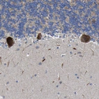 Immunohistochemical staining of human cerebellum shows strong granular cytoplasmic positivity in Purkinje cells.