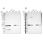 Western blot analysis using Anti-CCDC90B antibody HPA011931 (A) shows similar pattern to independent antibody HPA011130 (B).
