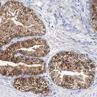 Anti-ACVR1C Antibody