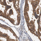 Immunohistochemical staining of human prostate shows strong cytoplasmic positivity in glandular cells.