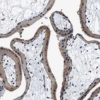 Immunohistochemical staining of human placenta shows moderate cytoplasmic positivity in trophoblastic cells.