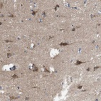 Anti-EFCAB14 Antibody