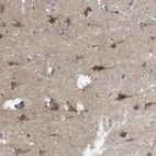 Anti-EFCAB14 Antibody