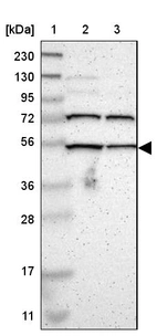 Lane 1: Marker [kDa] 230, 130, 95, 72, 56, 36, 28, 17, 11_br/_Lane 2: Human cell line RT-4_br/_Lane 3: Human cell line U-251MG sp