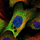 Immunofluorescent staining of human cell line U-2 OS shows localization to cytosol.