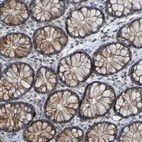 Immunohistochemical staining of human colon shows moderate cytoplasmic granular positivity in glandular cells.