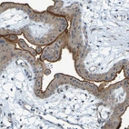Immunohistochemical staining of human placenta shows strong cytoplasmic granular positivity in trophoblastic cells.
