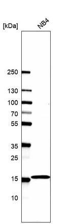 Western blot analysis in human cell line NB4.