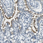 Immunohistochemical staining of human small intestine shows strong positivity in apical membrane in glandular cells.