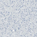Immunohistochemical staining of human liver shows no positivity in hepatocytes as expected.