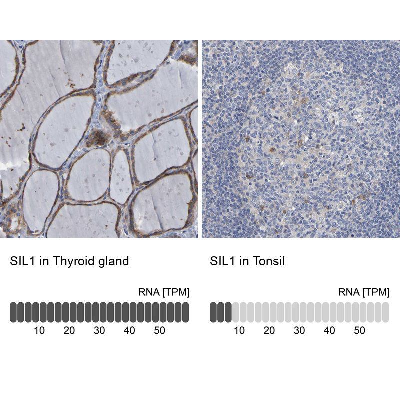 Anti-SIL1 Antibody