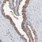 Immunohistochemical staining of human prostate shows moderate granular cytoplasmic positivity in glandular cells.