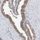 Immunohistochemical staining of human prostate shows moderate granular cytoplasmic positivity in glandular cells.