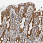 Immunohistochemical staining of human rectum shows moderate granular cytoplasmic positivity in glandular cells.