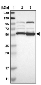 Lane 1: Marker [kDa] 230, 130, 95, 72, 56, 36, 28, 17, 11_br/_Lane 2: Human cell line RT-4_br/_Lane 3: Human cell line U-251MG sp