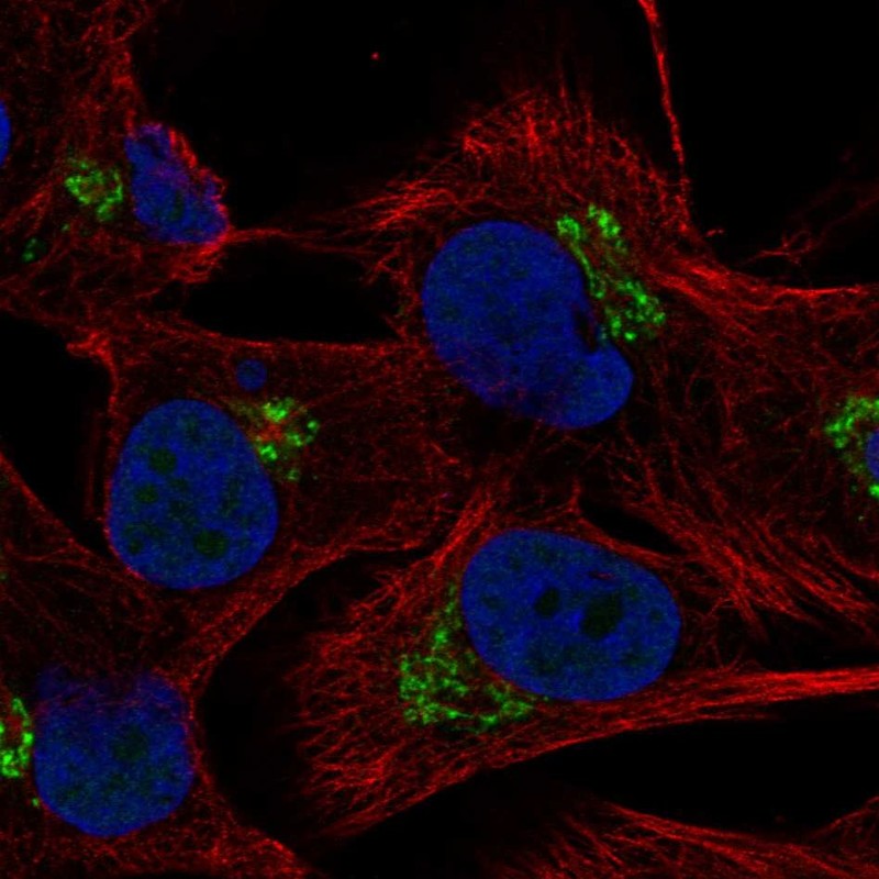 Anti-C5orf15 Antibody