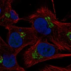 Anti-C5orf15 Antibody