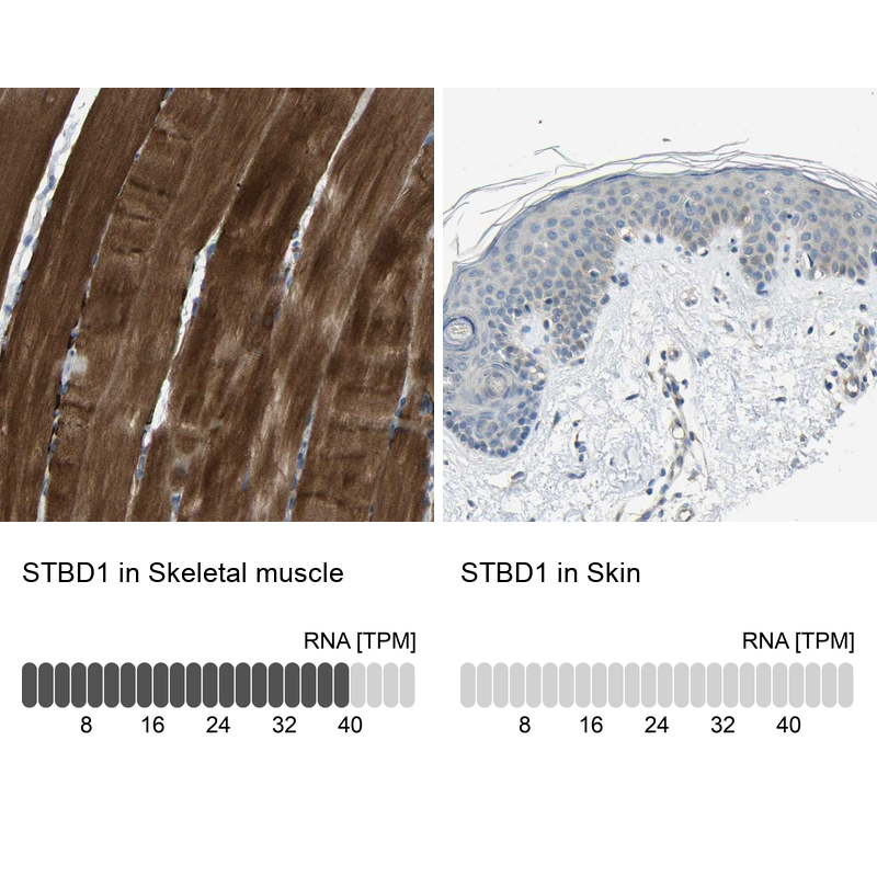 Anti-STBD1 Antibody