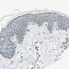 Immunohistochemical staining of human skin shows low expression as expected.
