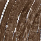 Immunohistochemical staining of human skeletal muscle shows high expression.