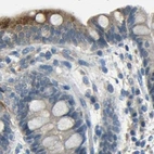Immunohistochemical staining of human colon using Anti-STBD1 antibody HPA011952.
