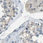 Immunohistochemical staining of human testis using Anti-STBD1 antibody HPA011952.