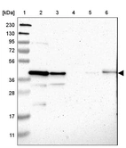 Lane 1: Marker [kDa] 230, 130, 95, 72, 56, 36, 28, 17, 11_br/_Lane 2: Human cell line RT-4_br/_Lane 3: Human cell line U-251MG sp_br/_Lane 4: Human plasma (IgG/HSA depleted)_br/_Lane 5: Human liver tissue_br/_Lane 6: Human tonsil tissue