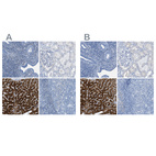 Anti-ASGR1 Antibody