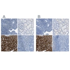 Immunohistochemical staining of human endometrium, kidney, liver and tonsil using Anti-ASGR1 antibody HPA011954 (A) shows similar protein distribution across tissues to independent antibody HPA012852 (B).