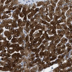 Immunohistochemical staining of human liver shows strong cytoplasmic positivity in hepatocytes.