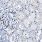 Anti-ASGR1 Antibody