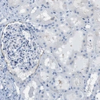 Immunohistochemical staining of human kidney shows no positivity in cells in tubules as expected.