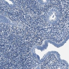 Immunohistochemical staining of human endometrium shows no positivity in glandular cells as expected.