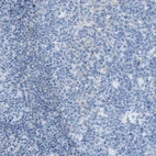 Immunohistochemical staining of human tonsil shows no positivity in germinal center cells as expected.